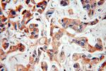 NAT1 Antibody in Immunohistochemistry (Paraffin) (IHC (P))