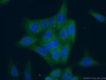 WDR45 Antibody in Immunocytochemistry (ICC/IF)
