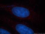 TMEM27 Antibody in Immunocytochemistry (ICC/IF)