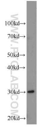 TMEM27 Antibody in Western Blot (WB)