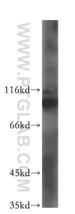 NUP107 Antibody in Western Blot (WB)