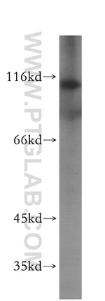 NUP107 Antibody in Western Blot (WB)