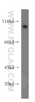 NUP107 Antibody in Western Blot (WB)