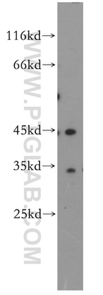 DNMT2 Antibody in Western Blot (WB)