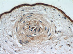 CD39/ENTPD1 Antibody in Immunohistochemistry (Paraffin) (IHC (P))
