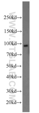 CD39/ENTPD1 Antibody in Western Blot (WB)