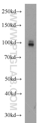 CD39/ENTPD1 Antibody in Western Blot (WB)