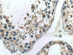 ATN1 Antibody in Immunohistochemistry (Paraffin) (IHC (P))