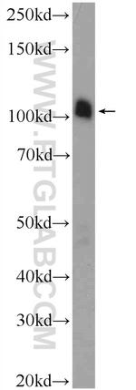 ATN1 Antibody in Western Blot (WB)