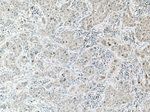 KIF18A Antibody in Immunohistochemistry (Paraffin) (IHC (P))