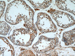 SKAP55 Antibody in Immunohistochemistry (Paraffin) (IHC (P))