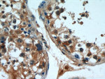 SKAP55 Antibody in Immunohistochemistry (Paraffin) (IHC (P))
