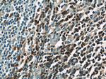 SKAP55 Antibody in Immunohistochemistry (Paraffin) (IHC (P))