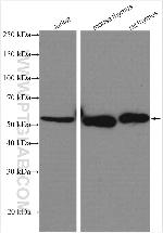 SKAP55 Antibody in Western Blot (WB)