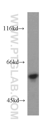 SKAP55 Antibody in Western Blot (WB)