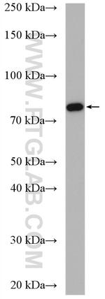TNFR2 Antibody in Western Blot (WB)