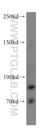 TNFR2 Antibody in Western Blot (WB)