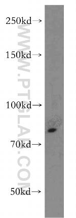 TNFR2 Antibody in Western Blot (WB)