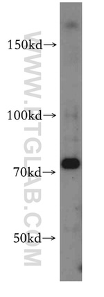 TNFR2 Antibody in Western Blot (WB)