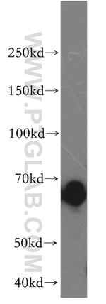 OAS2 Antibody in Western Blot (WB)