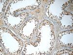 IFT122 Antibody in Immunohistochemistry (Paraffin) (IHC (P))