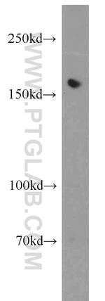 Tie1 Antibody in Western Blot (WB)