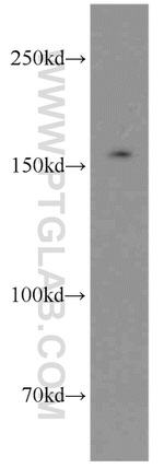 Tie1 Antibody in Western Blot (WB)