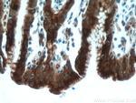 Gastrokine 1 Antibody in Immunohistochemistry (Paraffin) (IHC (P))