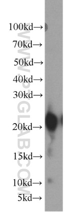 Gastrokine 1 Antibody in Western Blot (WB)