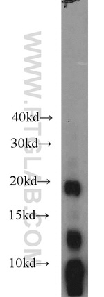 Gastrokine 1 Antibody in Western Blot (WB)
