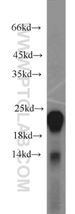 Gastrokine 1 Antibody in Western Blot (WB)