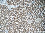 ADHFE1 Antibody in Immunohistochemistry (Paraffin) (IHC (P))