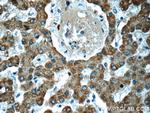 ADHFE1 Antibody in Immunohistochemistry (Paraffin) (IHC (P))