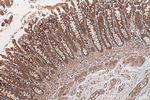 ADHFE1 Antibody in Immunohistochemistry (Paraffin) (IHC (P))