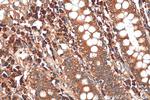 ADHFE1 Antibody in Immunohistochemistry (Paraffin) (IHC (P))
