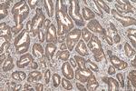 ADHFE1 Antibody in Immunohistochemistry (Paraffin) (IHC (P))
