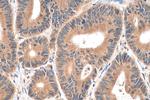 ADHFE1 Antibody in Immunohistochemistry (Paraffin) (IHC (P))