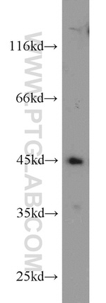 ADHFE1 Antibody in Western Blot (WB)