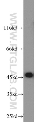 ADHFE1 Antibody in Western Blot (WB)