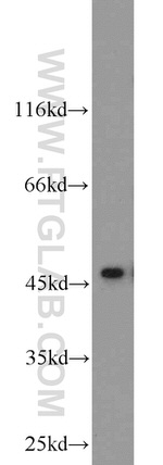 ADHFE1 Antibody in Western Blot (WB)