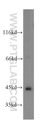 ADHFE1 Antibody in Western Blot (WB)