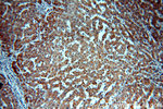 SLC25A20 Antibody in Immunohistochemistry (Paraffin) (IHC (P))