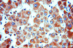 SLC25A20 Antibody in Immunohistochemistry (Paraffin) (IHC (P))