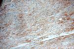 SLC25A20 Antibody in Immunohistochemistry (Paraffin) (IHC (P))
