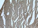 SLC25A20 Antibody in Immunohistochemistry (Paraffin) (IHC (P))