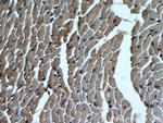 SLC25A20 Antibody in Immunohistochemistry (Paraffin) (IHC (P))