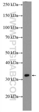 SLC25A20 Antibody in Western Blot (WB)