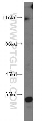 SLC25A20 Antibody in Western Blot (WB)