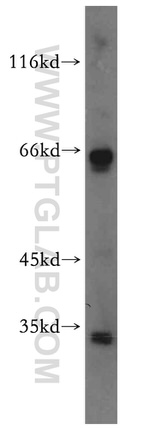 SLC25A20 Antibody in Western Blot (WB)