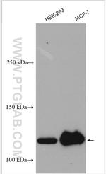 USP10 Antibody in Western Blot (WB)